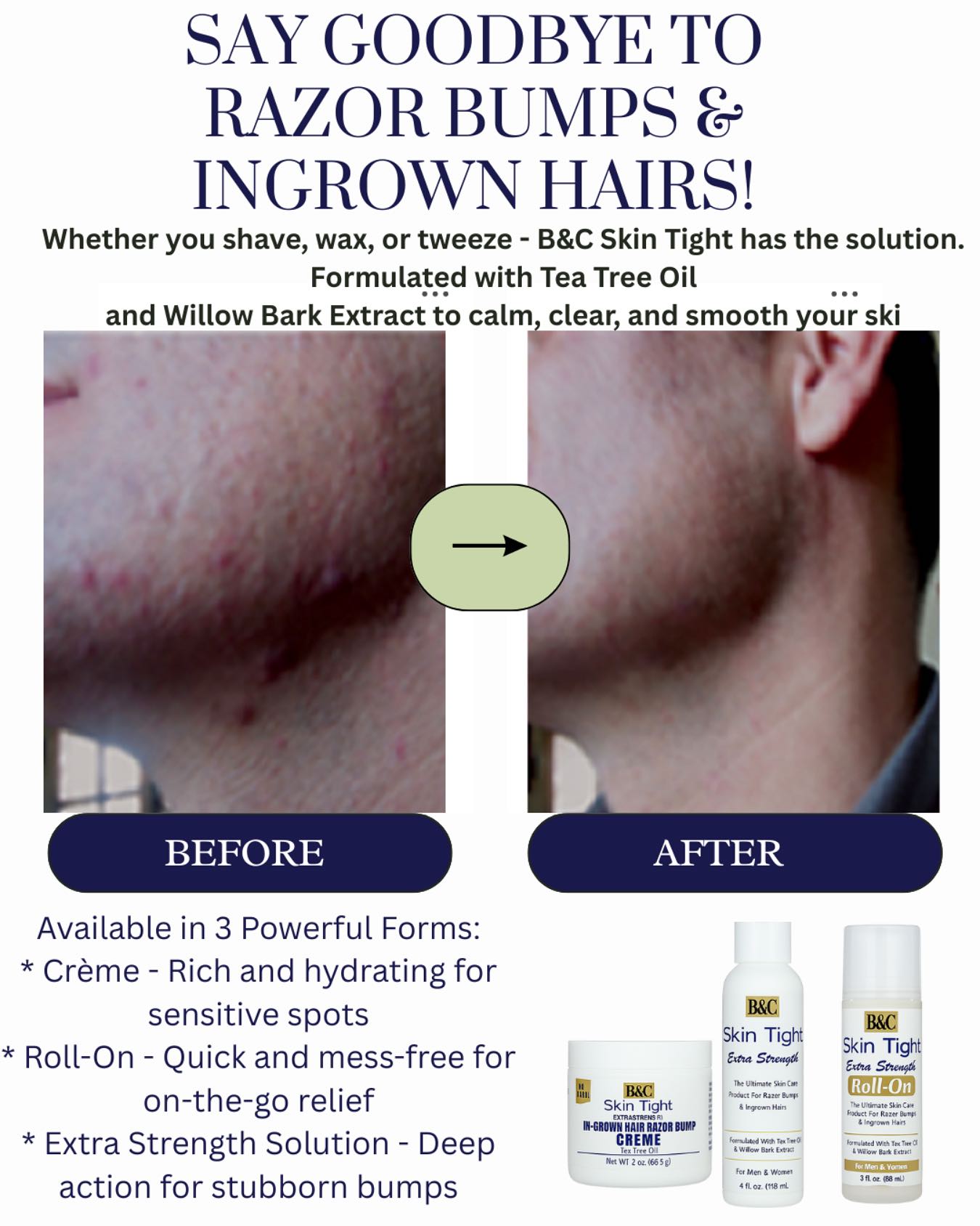 Skin Tight Facebook ad: Say Goodbye to Razor Bumps & Ingrown Hairs!