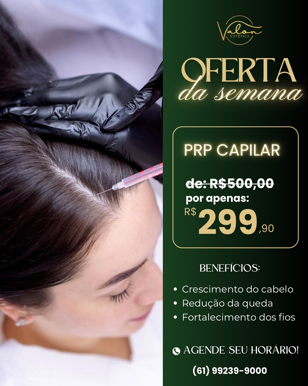 Valon estética 02 Facebook ad: Seu cabelo está caindo mais do que o…