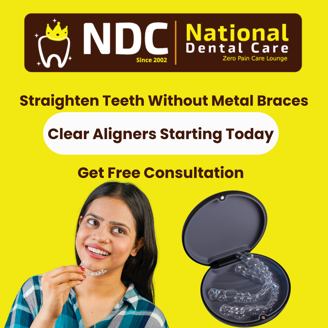 NDC Hyderabad Facebook ad: Special Offer on Clear Aligners