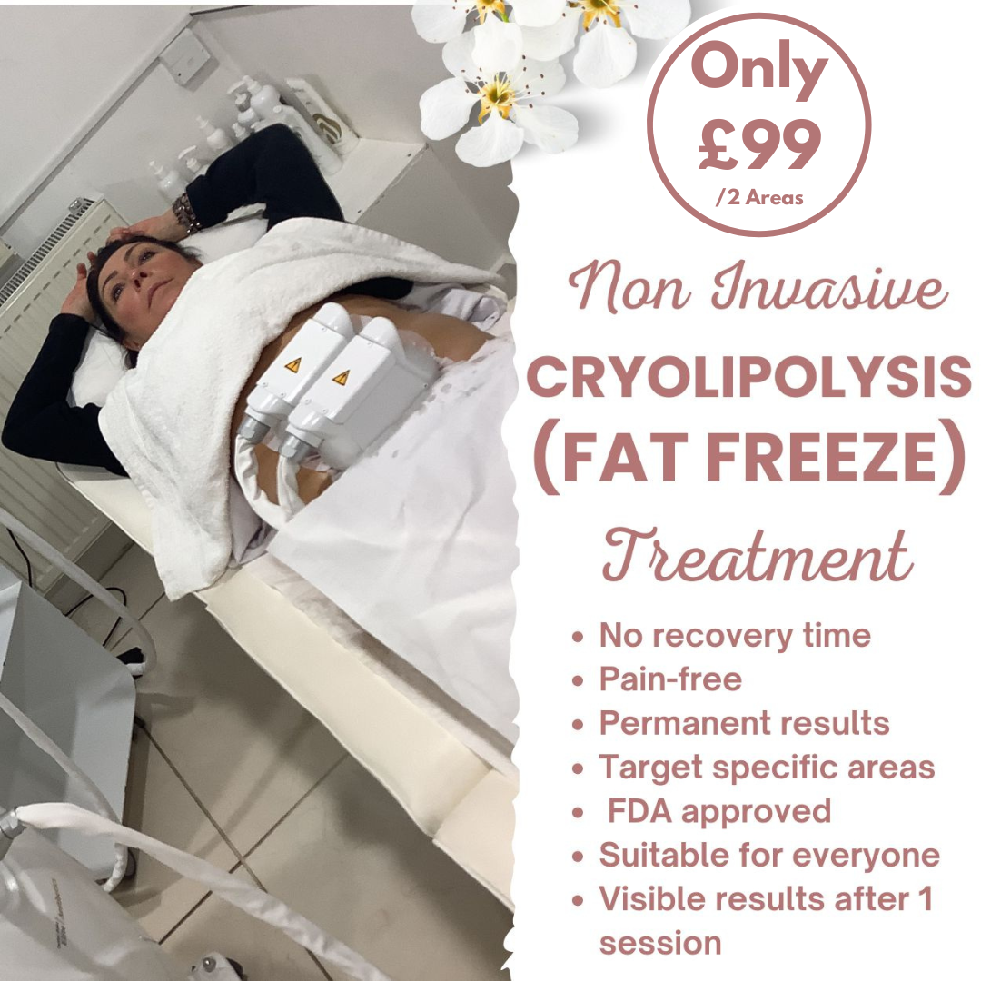 OSM Cosmetic Clinic Facebook ad: Flash Sale: Half-Price Cryo Treatments in Brentwood, Book…