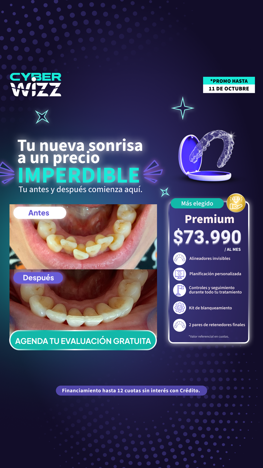 Wizz Chile Facebook ad: Alineadores en cuotas | 6 cuotas *Sin tarjeta de crédito*