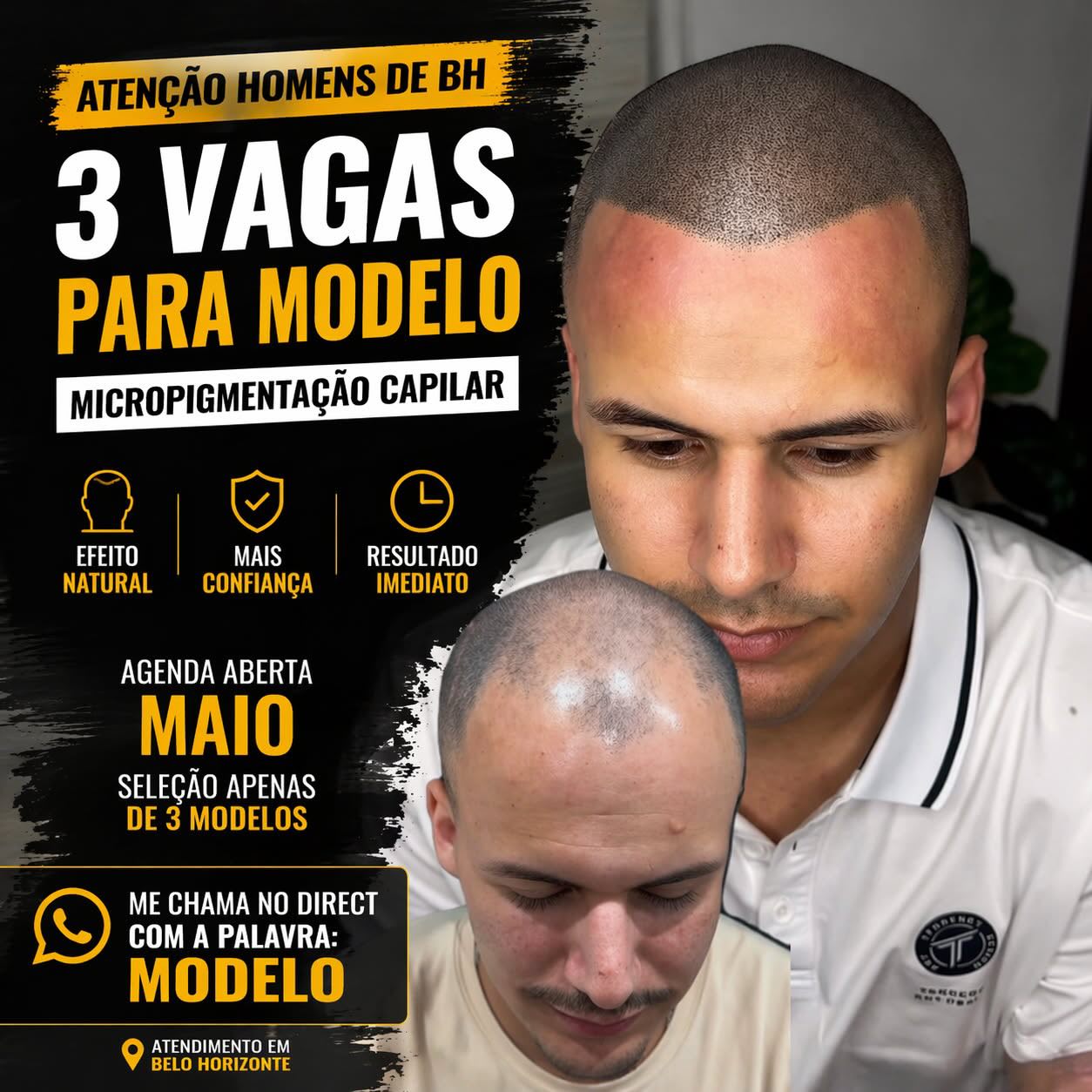 Mattos Micropigmentação capilar Facebook ad: Últimas vagas para modelo!
