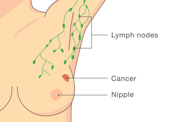 Health Guide Tips Facebook ad: Explore HER2 Impact on Treatment