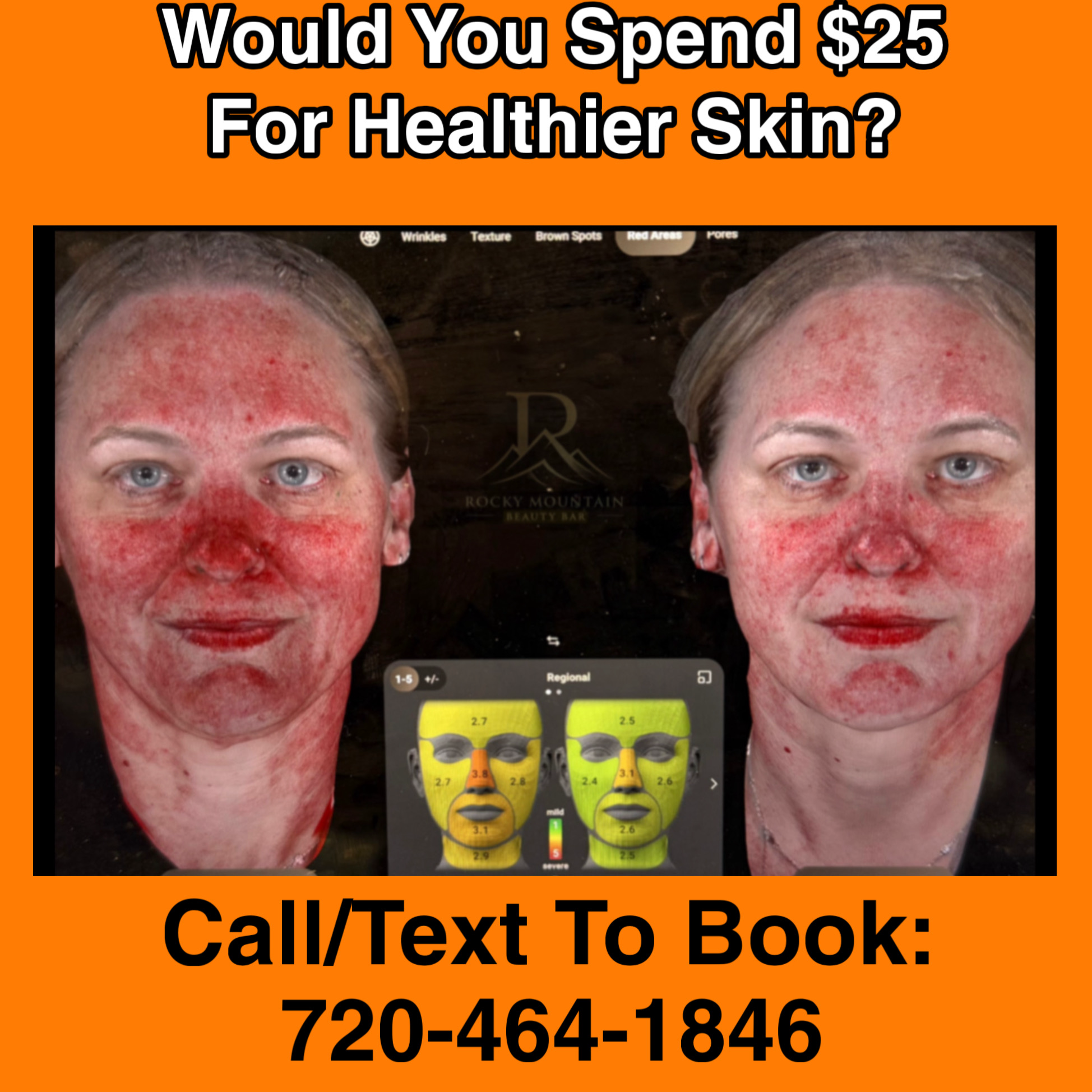 Rocky Mountain Beauty Bar Facebook ad