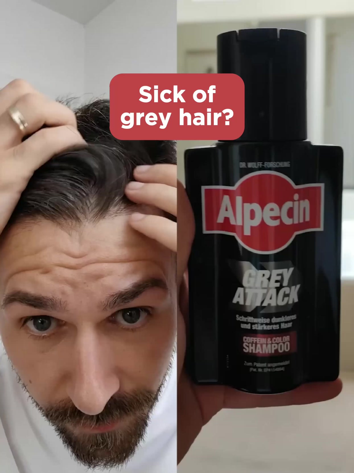 Alpecin Facebook ad: Attack Your Grey Hair!
