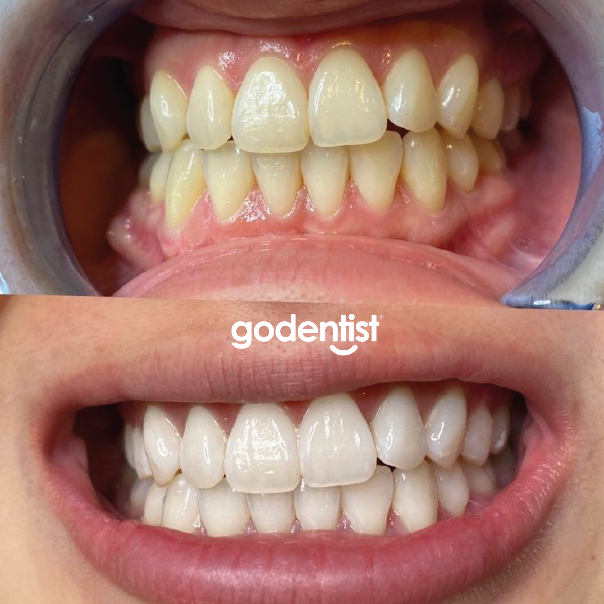 Clínicas Odontológicas Go Dentist Facebook ad
