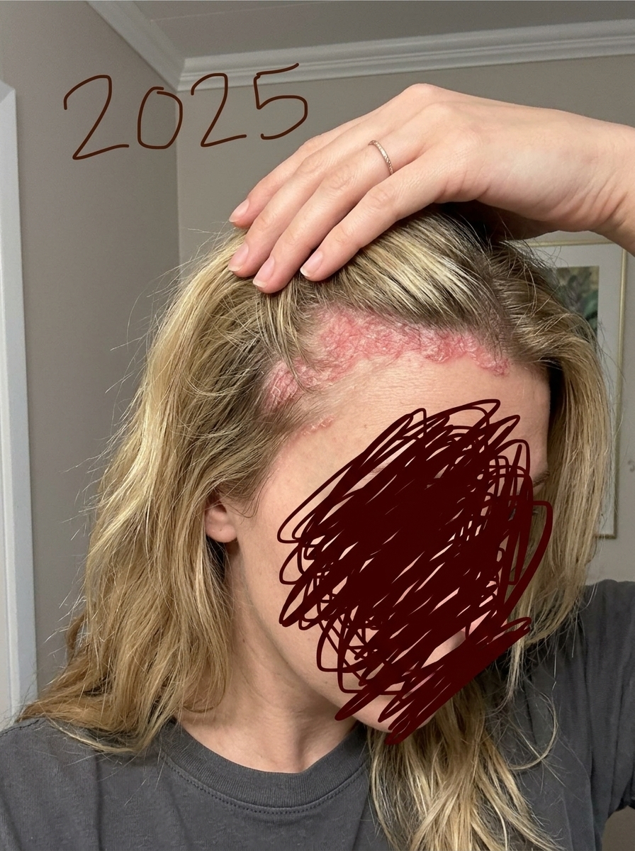 Susan Smith Facebook ad: My sister wouldn't stop pushing me to see her alternative…