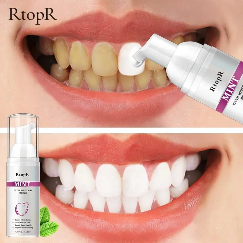 Simak Online Store Facebook ad: RtopR Mint Teeth Whitening Mousse - Deeply Cleaning Teeth…