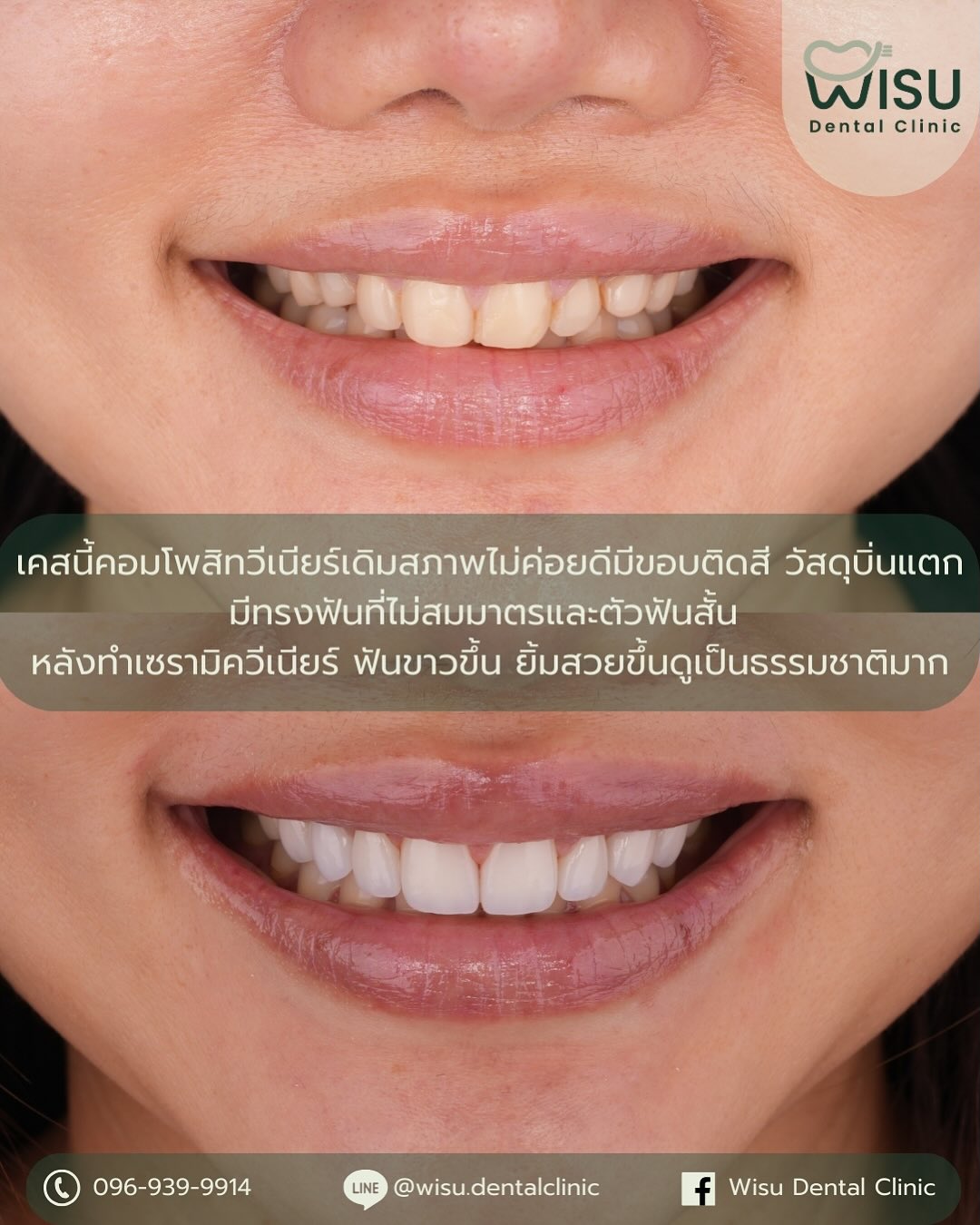 Wisu Dental Clinic คลินิกทันตกรรมหมอวิสุ Facebook ad from Dec 12, 2025