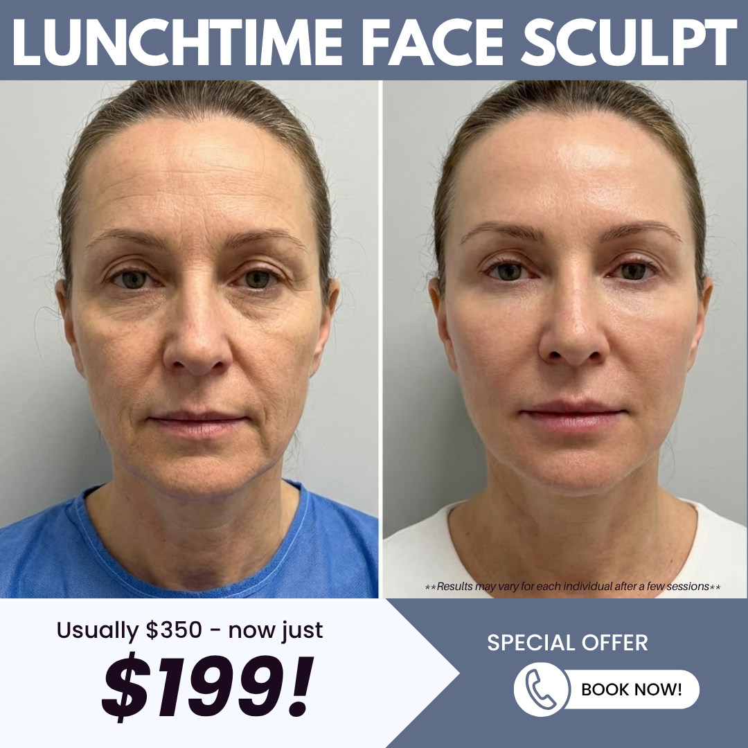 Park Ave Cosmetic Center Facebook ad: Get the Lunchtime Face Sculpt for ONLY $199!