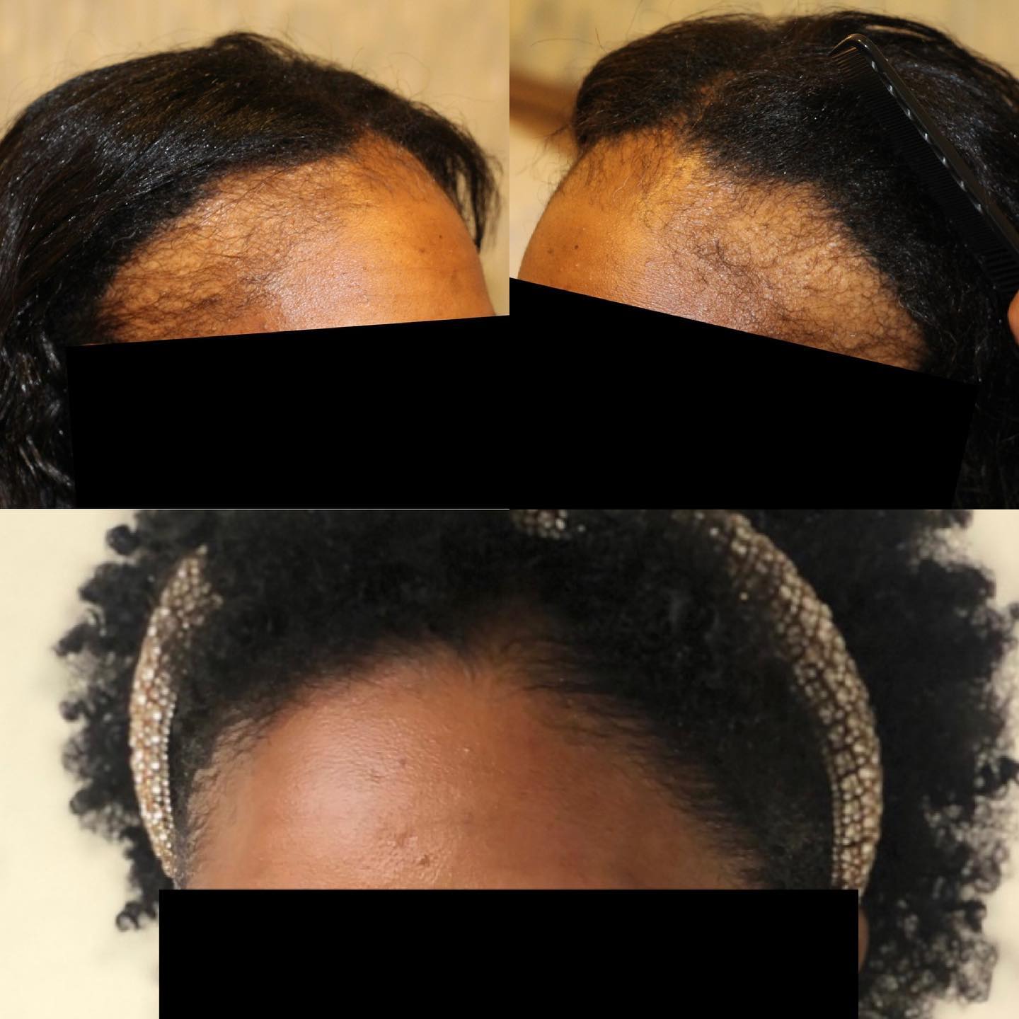 Modena Hair Institute Facebook ad
