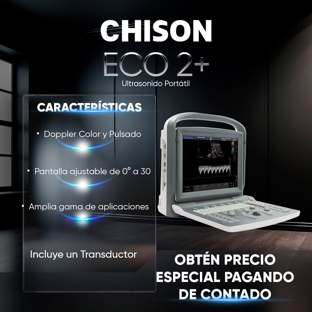 Chison México Facebook ad