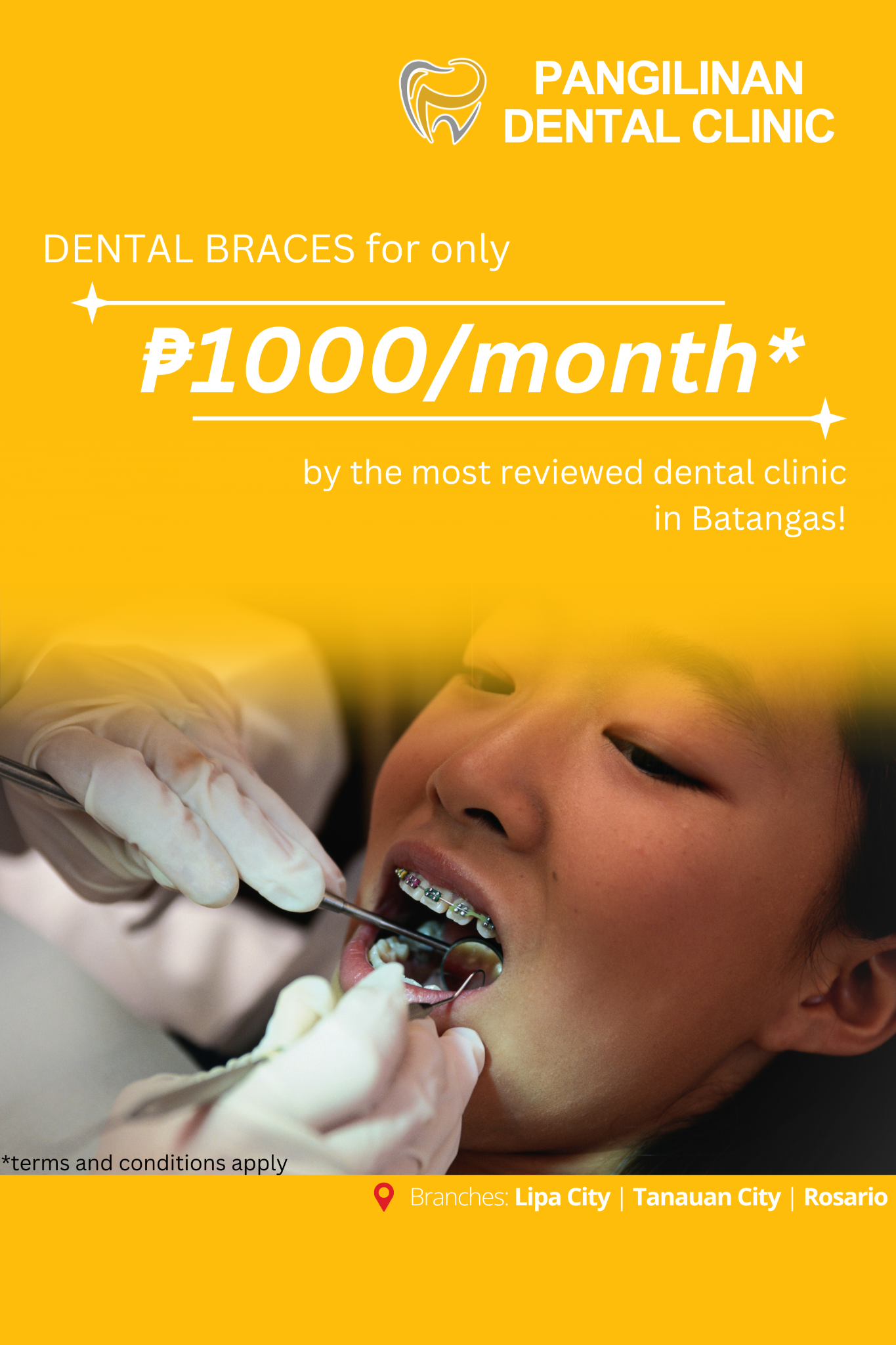 Pangilinan Dental Clinic Lipa Facebook ad