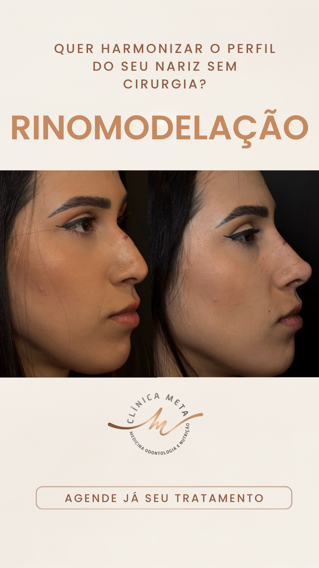 Clínica META - Medicina Integrativa e Estética Facebook ad from Jul 7, 2026