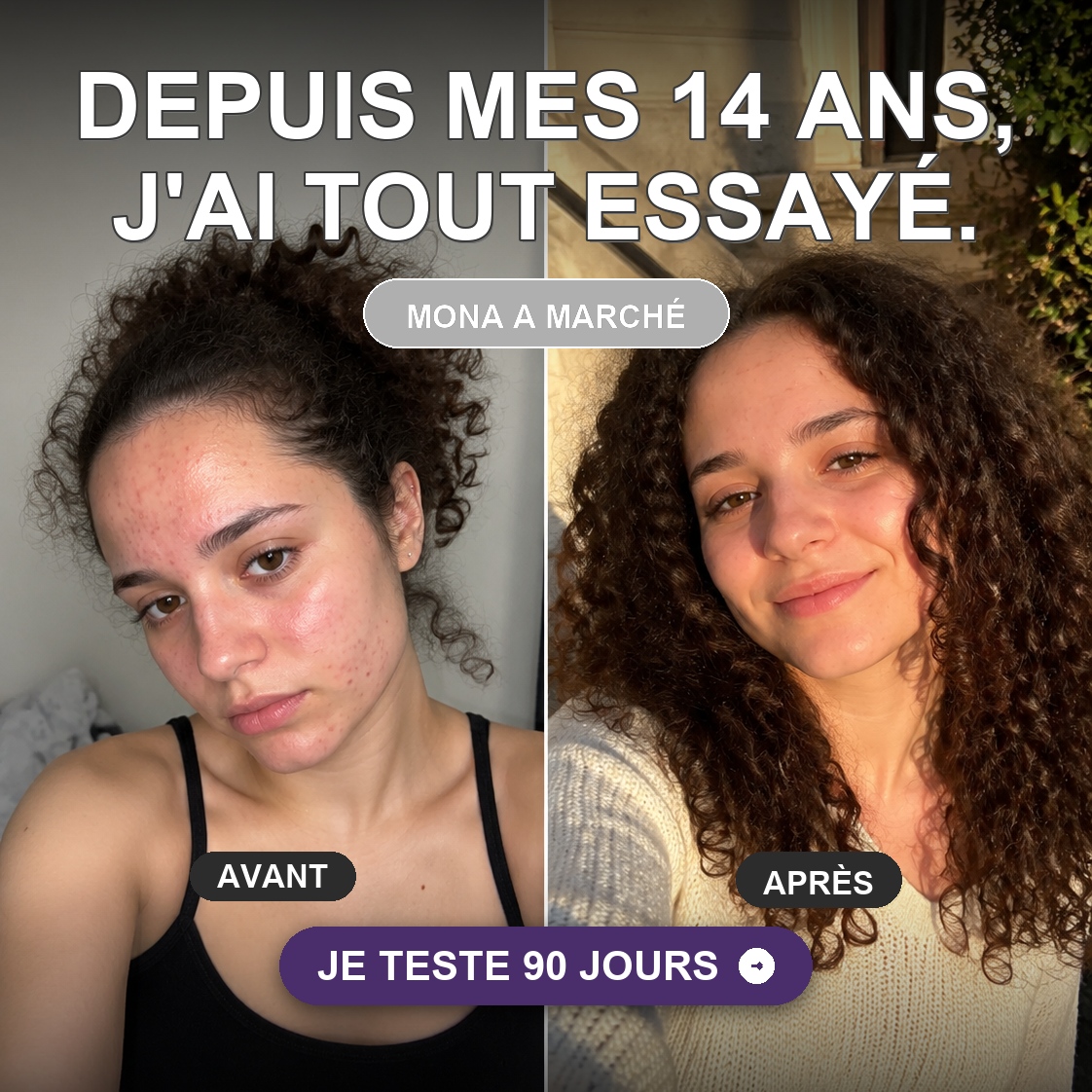 Mona Ritual Facebook ad: L'acné hormonale a sa cure.