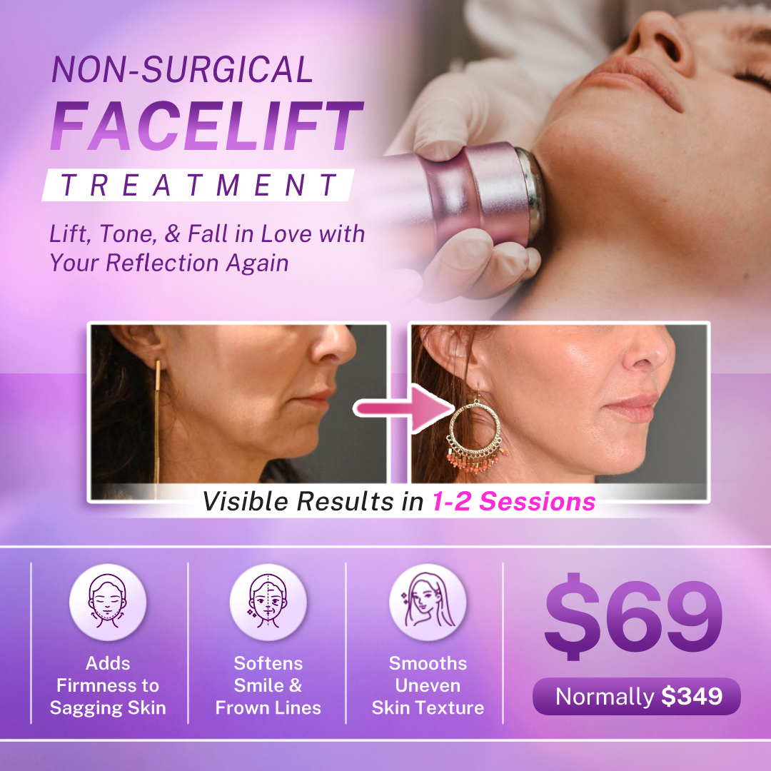 I Love Skin Treatments Facebook ad