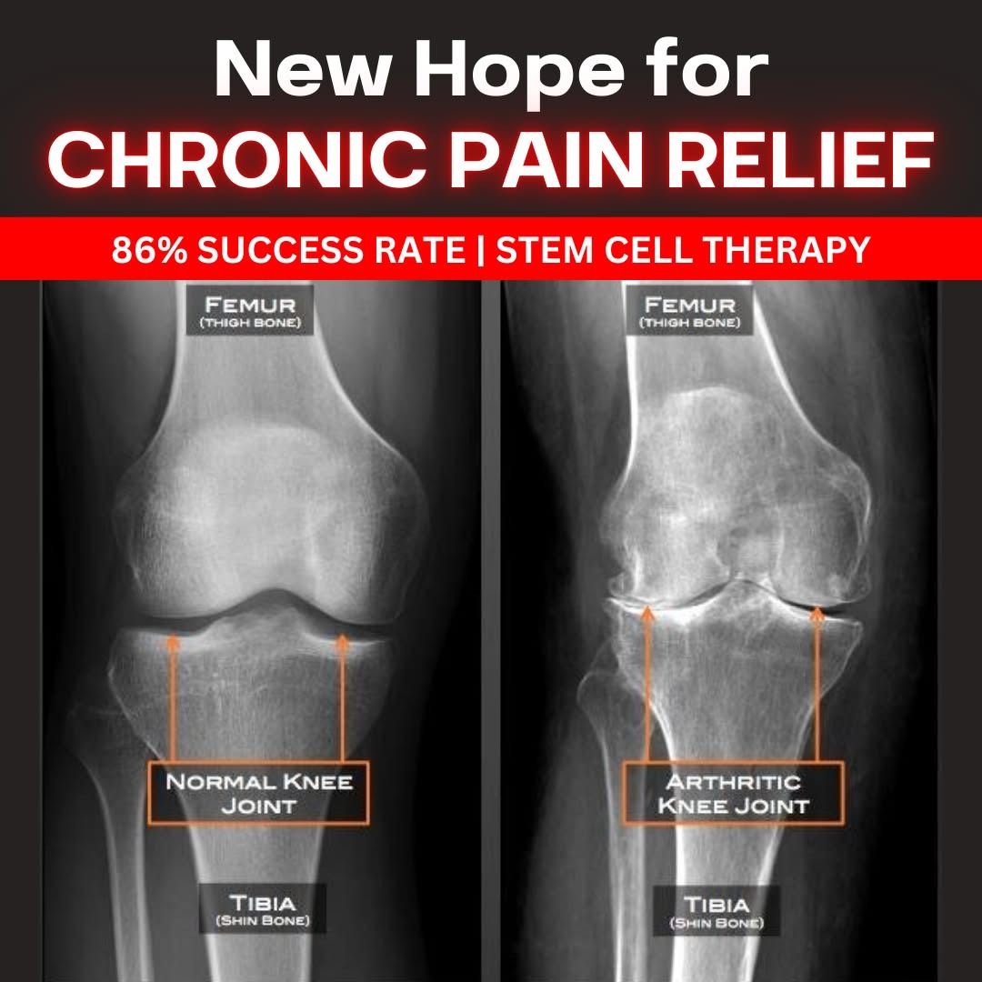 Integrated Pain Specialists Facebook ad: Avoid Surgery, New Pain Relief in Utah!