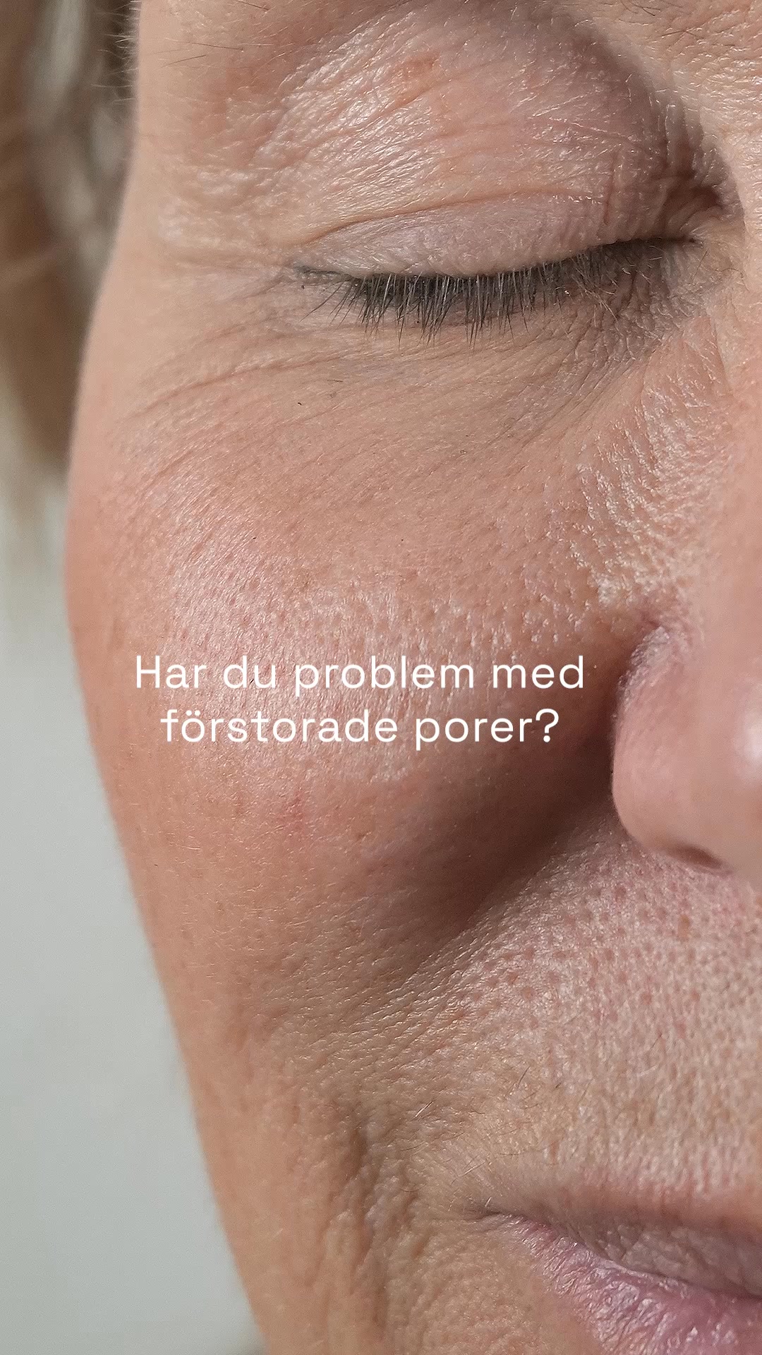 Skinome Facebook ad: Upptäck Retinal Concentrate