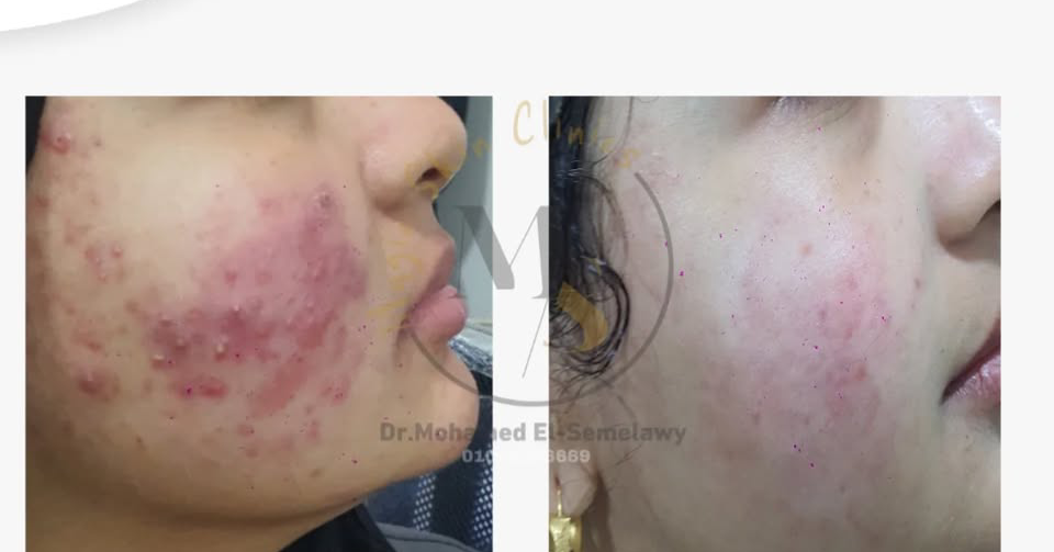 Magic skin clinics Facebook ad