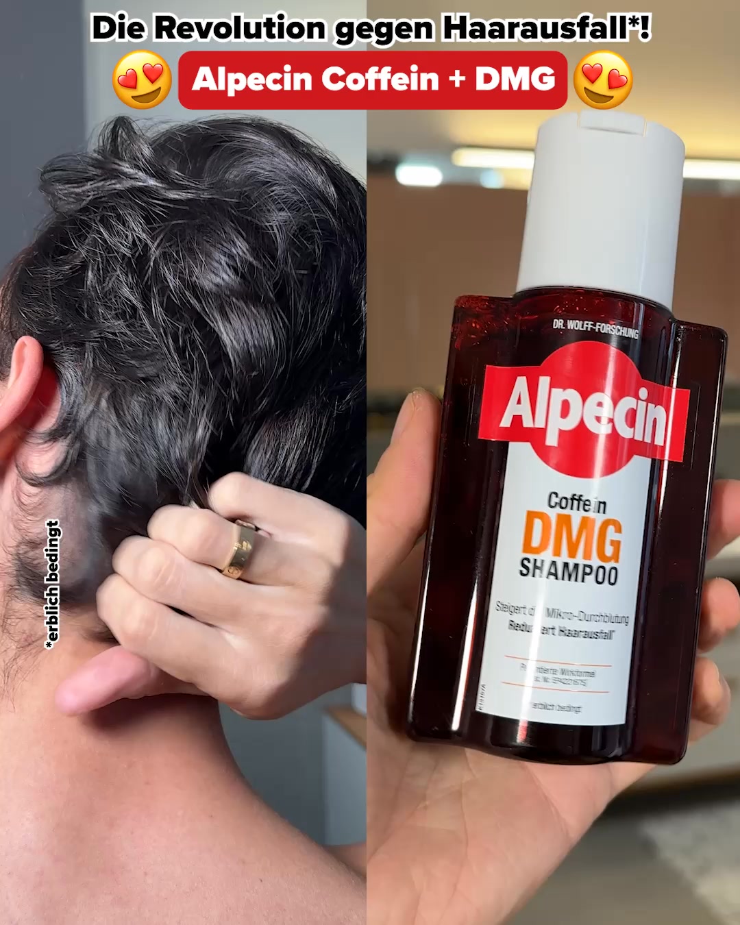 Alpecin Facebook ad: BREAKING NEWS