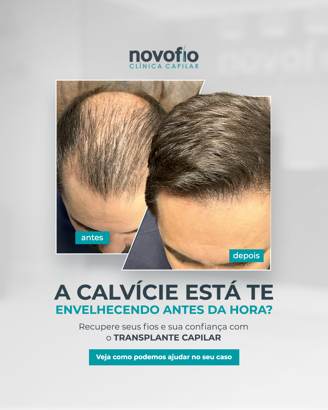 Novofio Natal Clínica Capilar Facebook ad