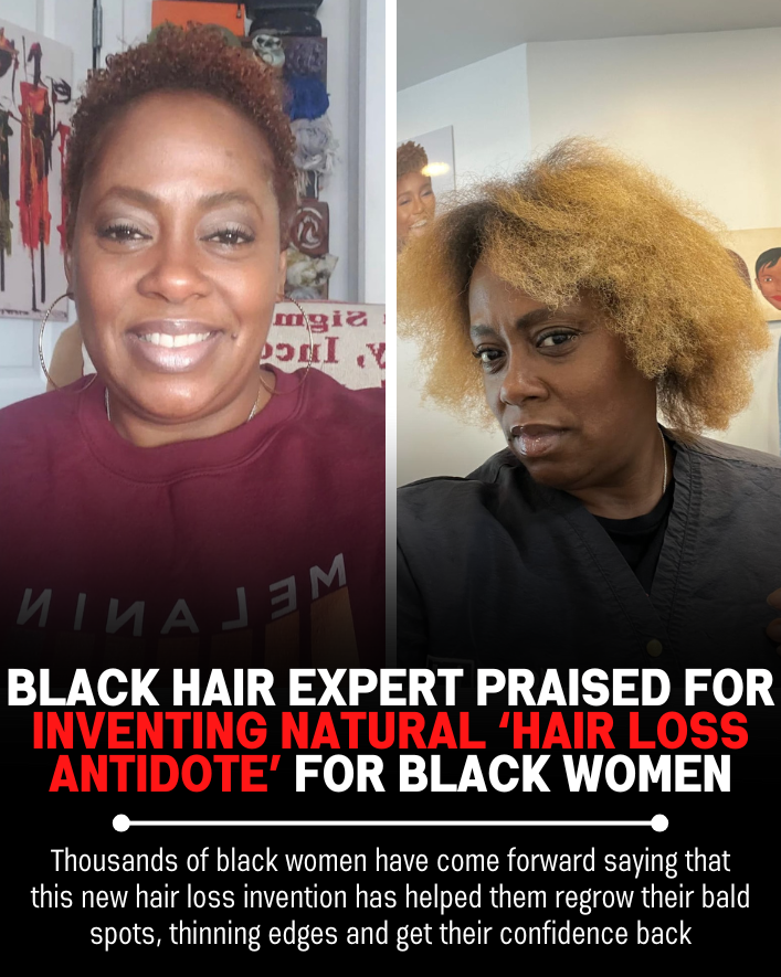 Black Hair Growth Remedy Facebook ad