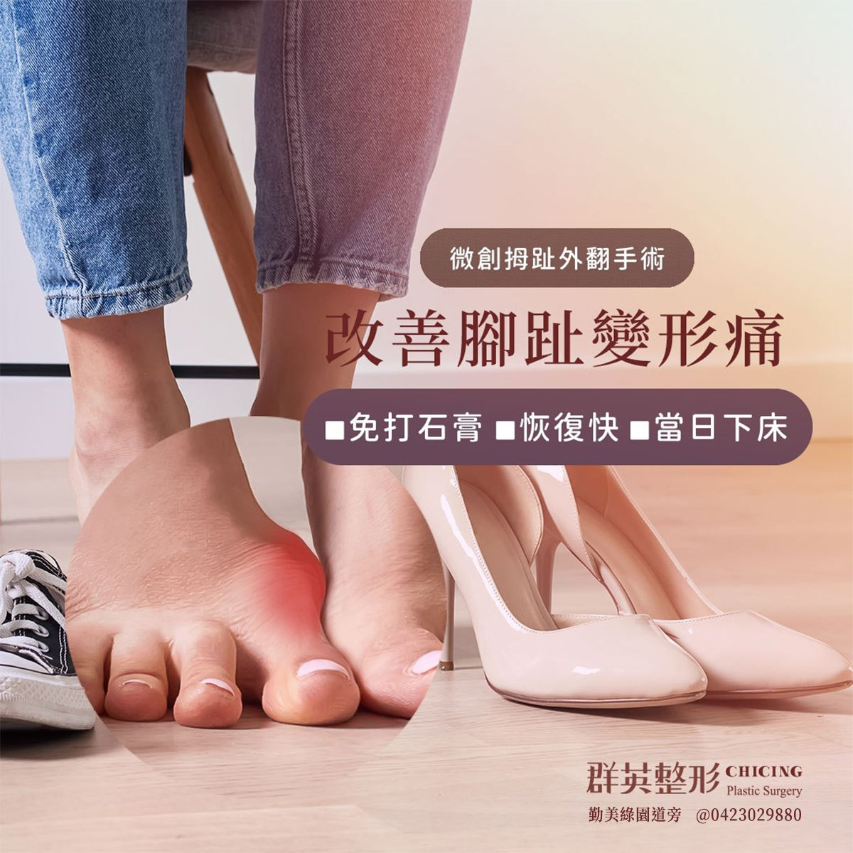 群英整形外科診所(台中勤美店 / 全台連鎖醫美) Facebook ad: 台中群英拇趾外翻手術,找回放鬆舒適的腳