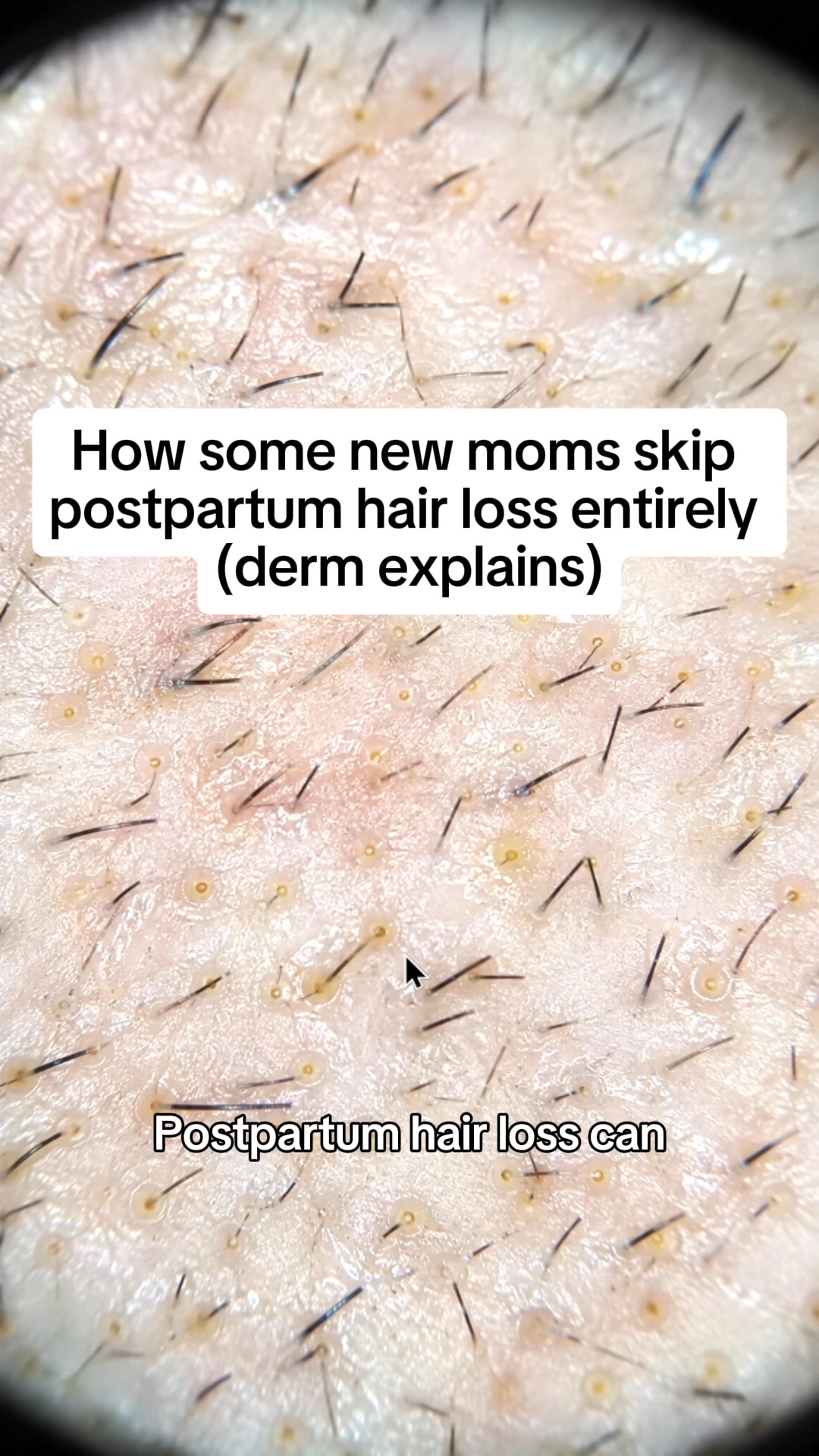 True Hair Forum Facebook ad: Restore Thicker, Healthier Hair (And Keep It)