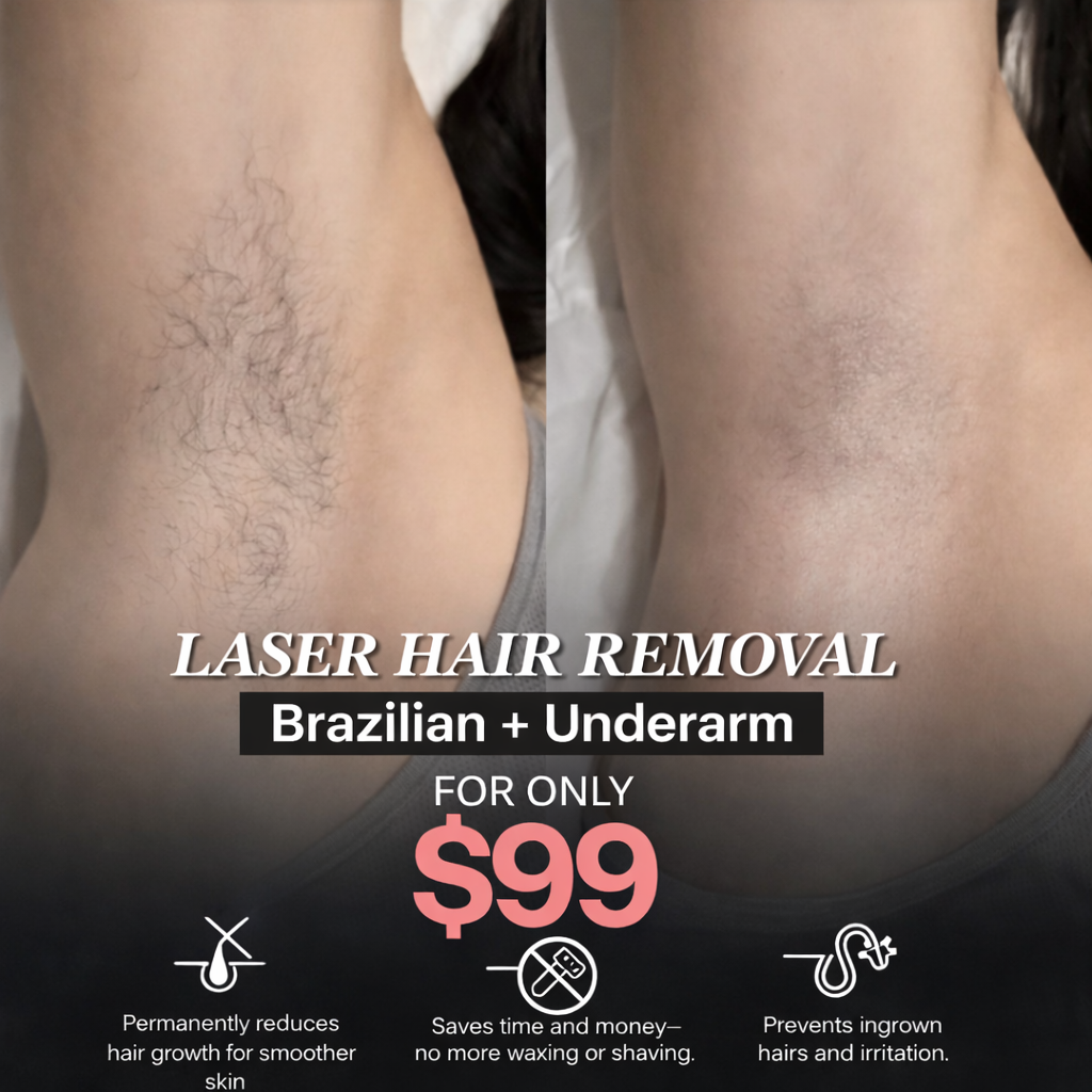 Maryam C Beauté Facebook ad: Limited Time Offer - Laser Hair Removal