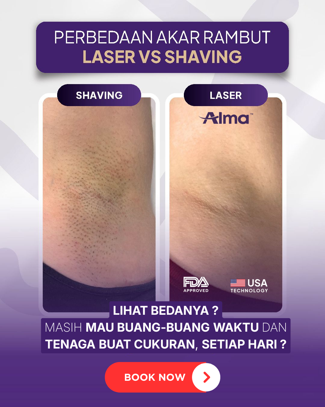 De-Hair Laser Hair Removal Facebook ad