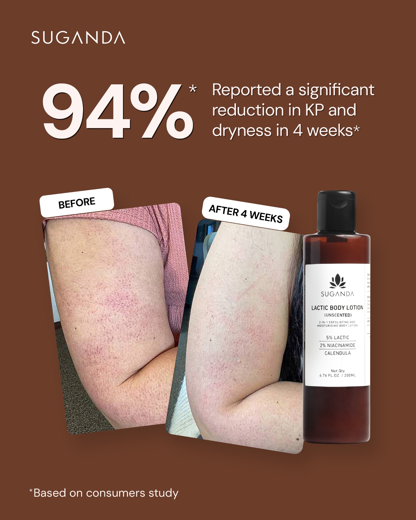 Suganda Skincare Facebook ad