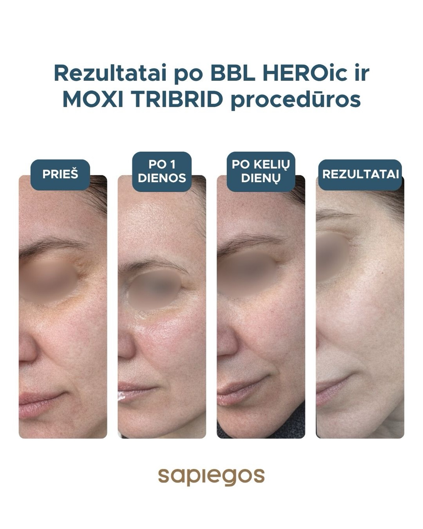 Sapiegos Klinika - Lazerinės Dermatologijos Klinika Facebook ad