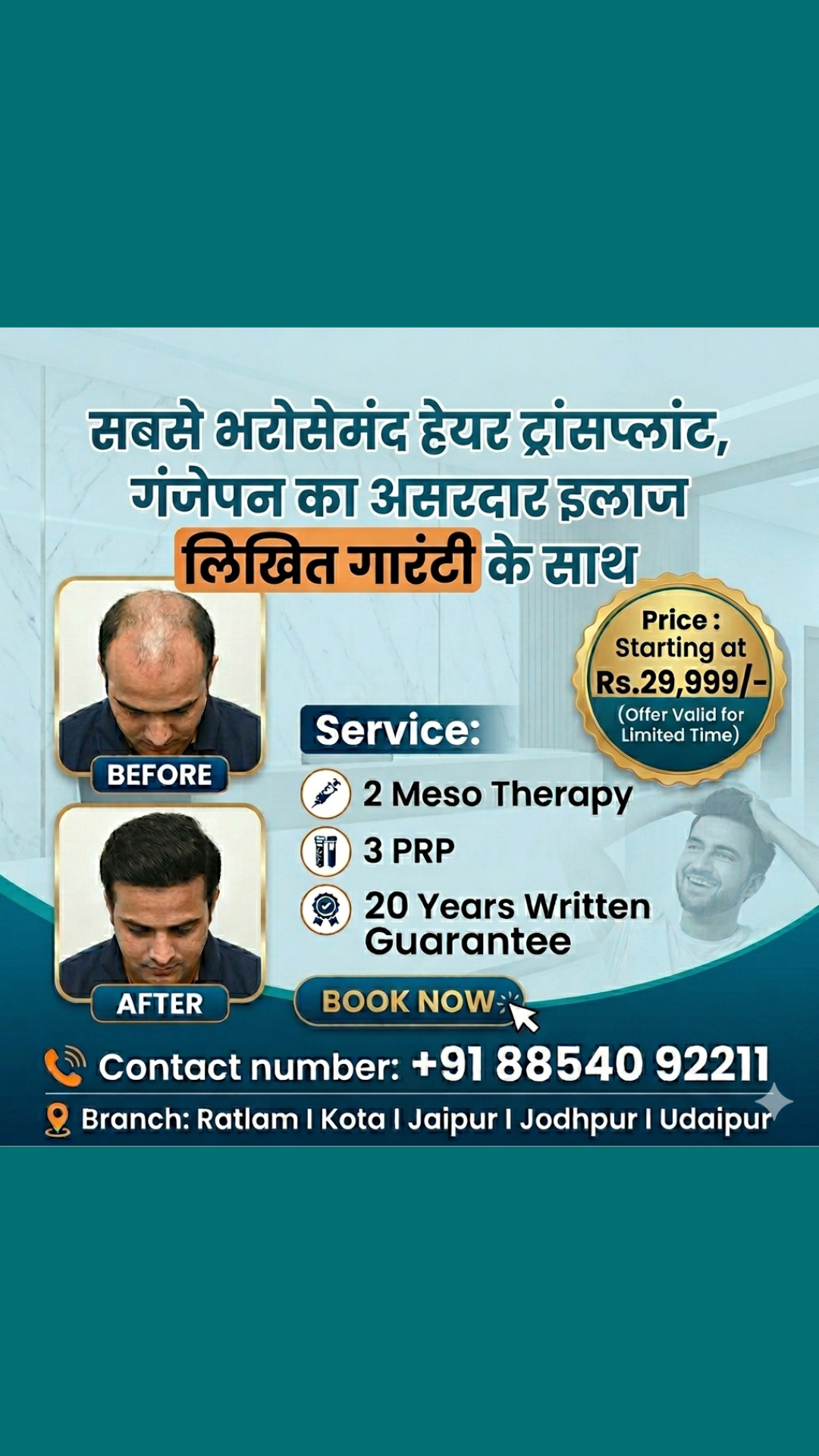 Best hair Transplant in Rajsthan-Udaypur-Kota,Jodhpur,Jaipur Facebook ad