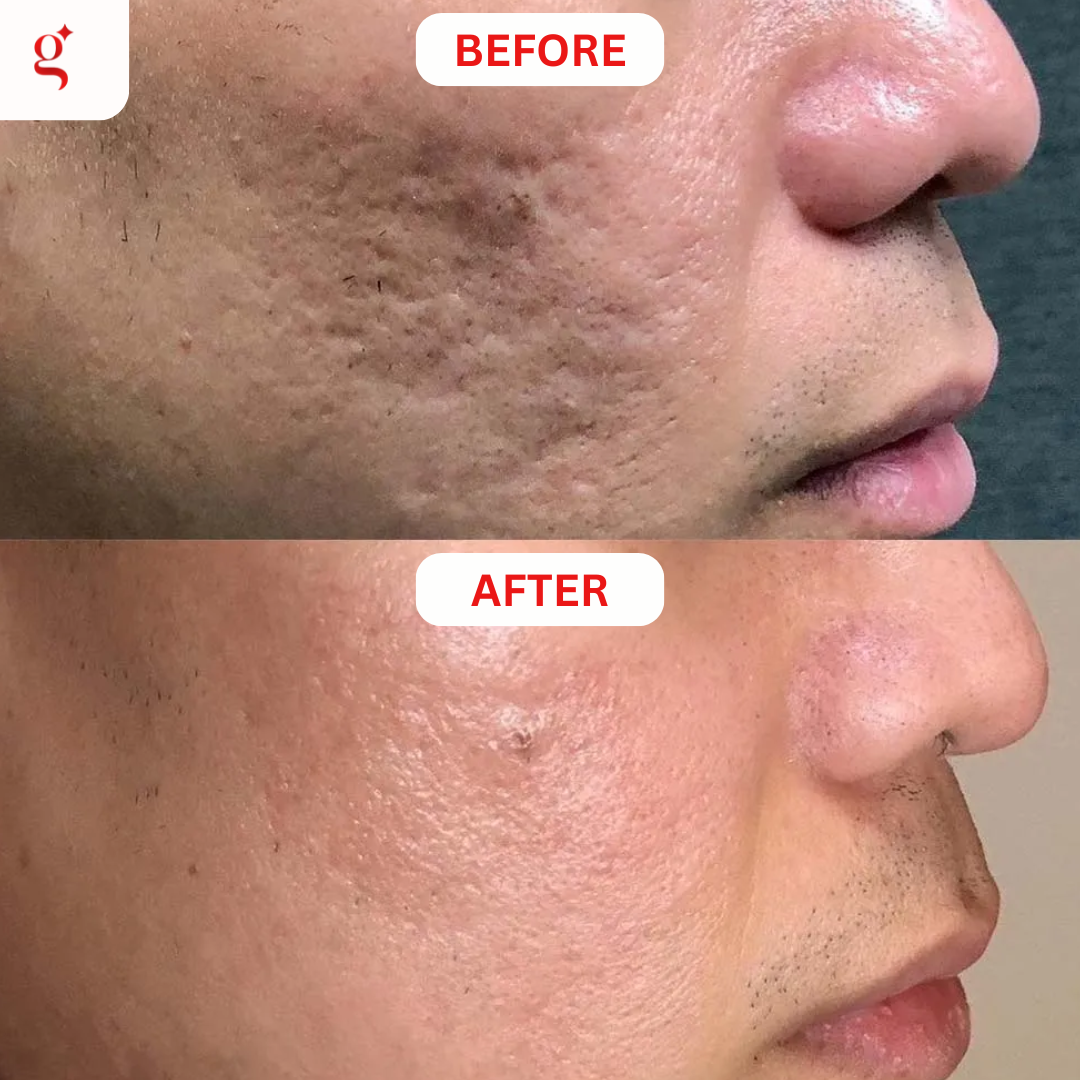 Glow & Go Facebook ad