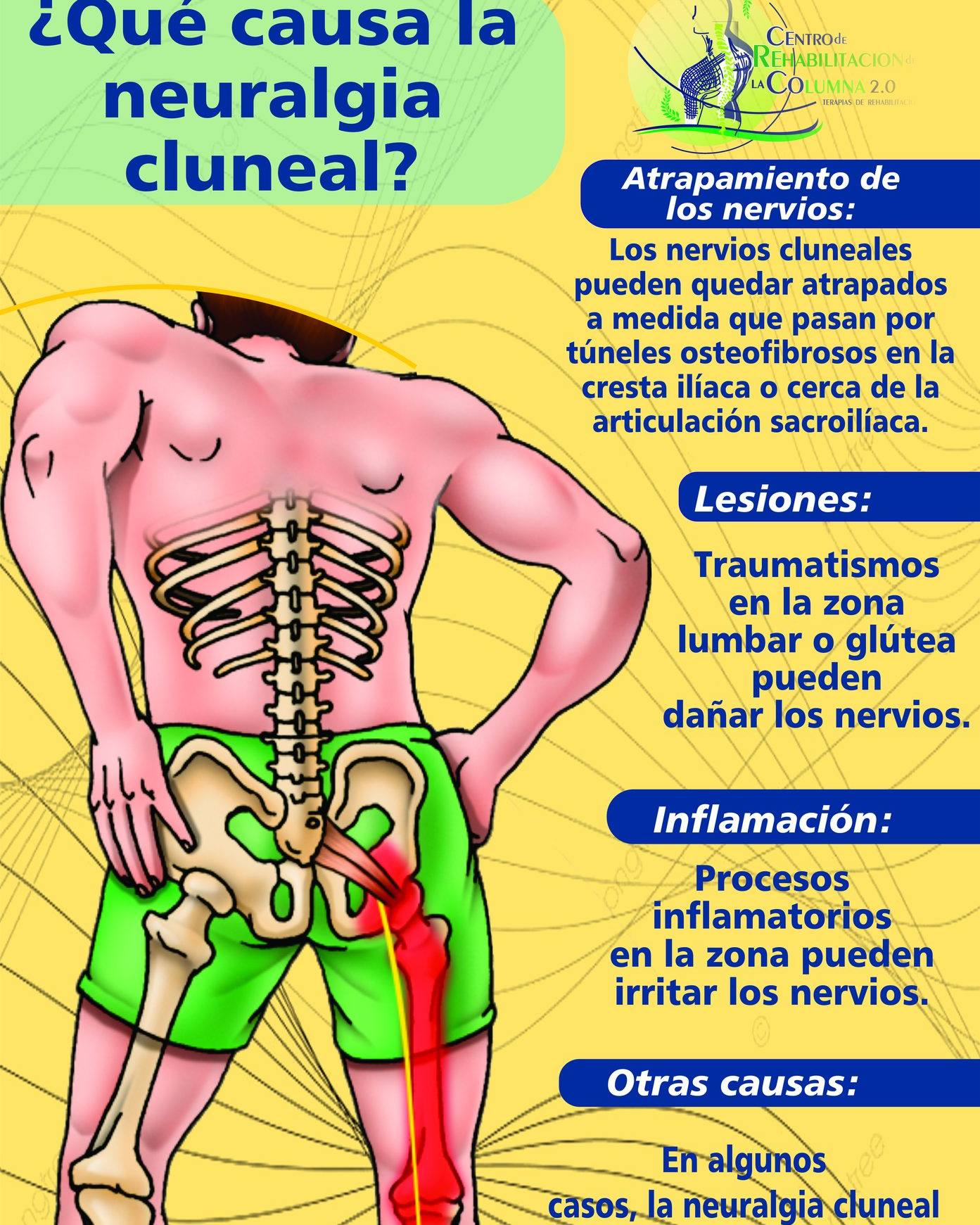 Centro de Relajación de la Columna SPA Tijuana Facebook ad: La neuralgia cluneal es una afección de dolor…