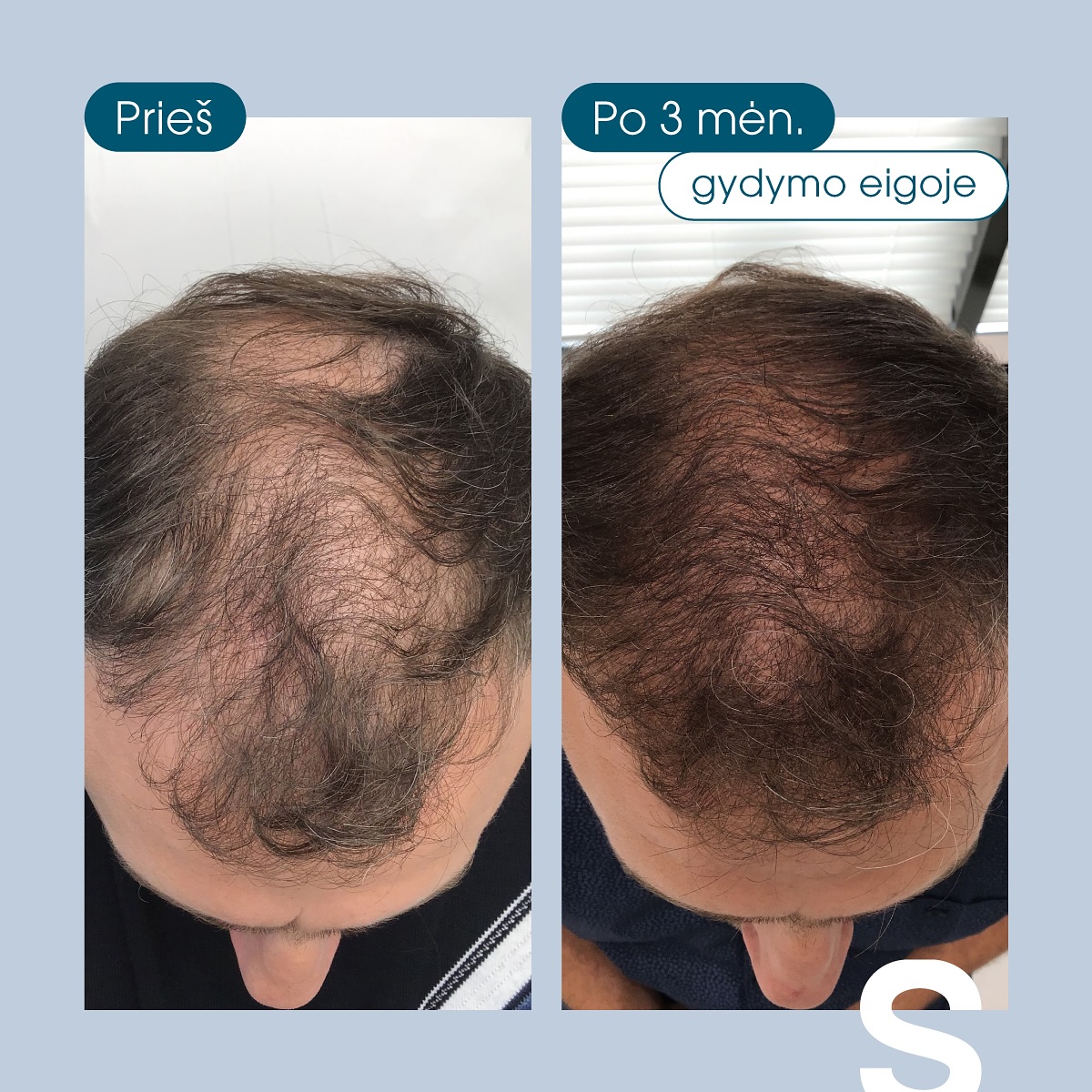 Sapiegos Klinika - Lazerinės Dermatologijos Klinika Facebook ad