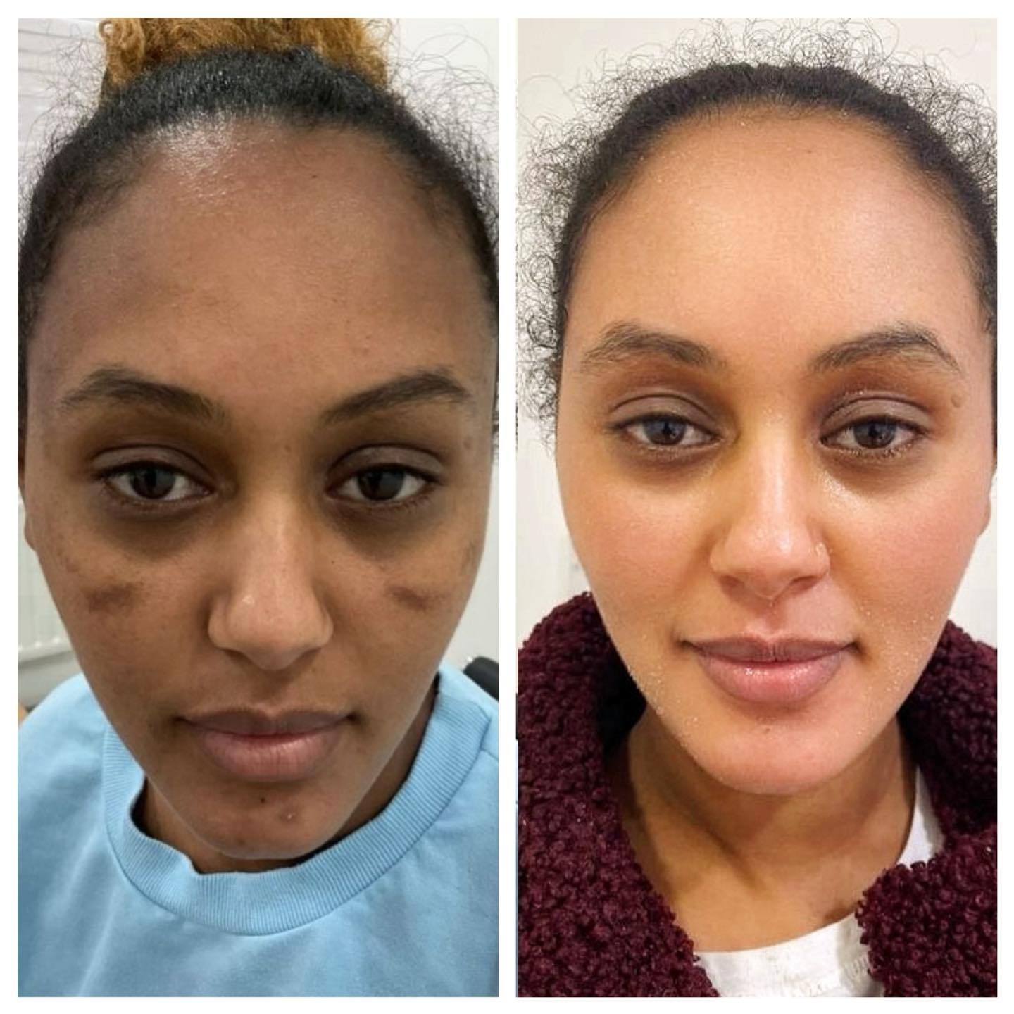Glow Treatments Facebook ad: Glow Treatments Happy Customers