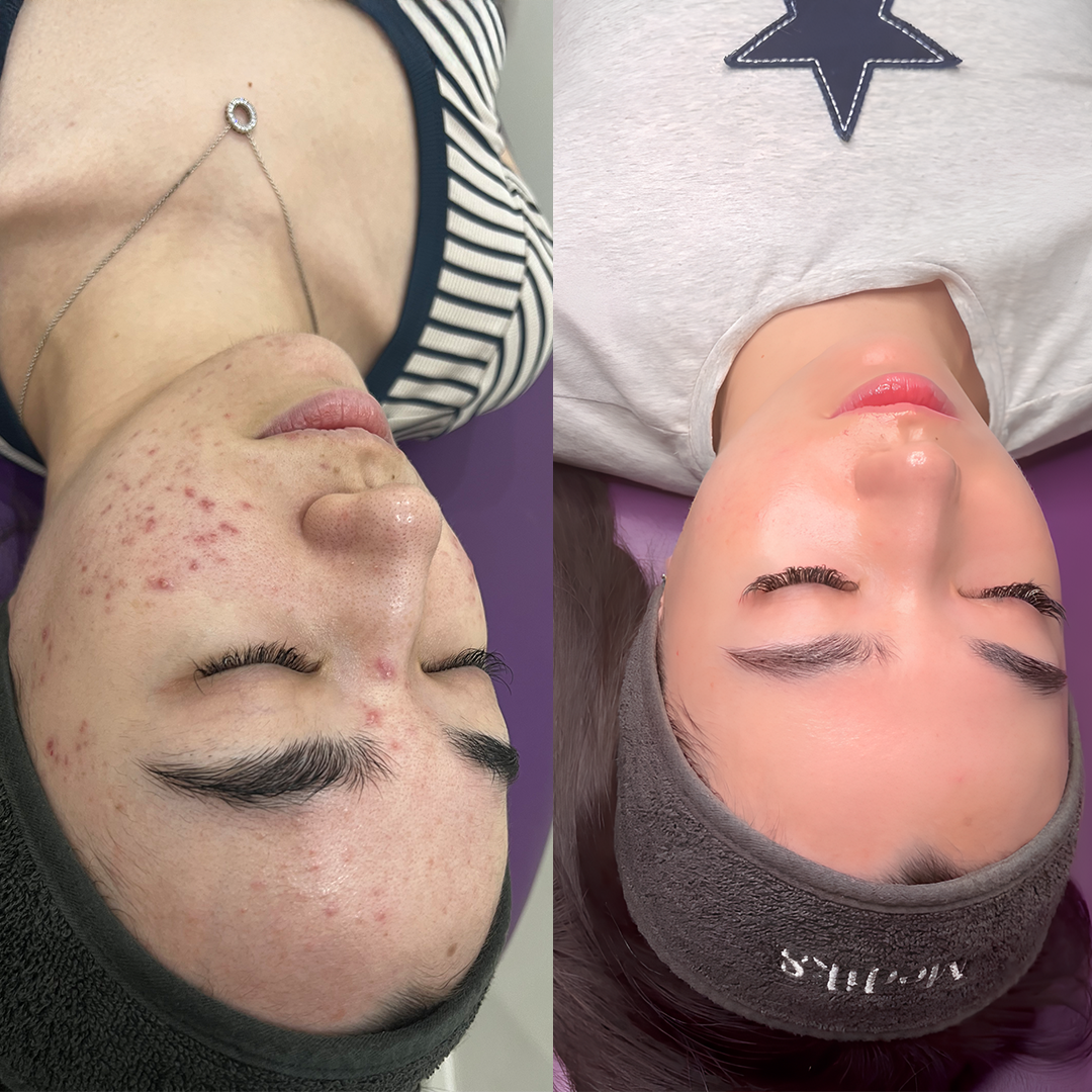 Sydney Dermal Lounge Revesby Facebook ad