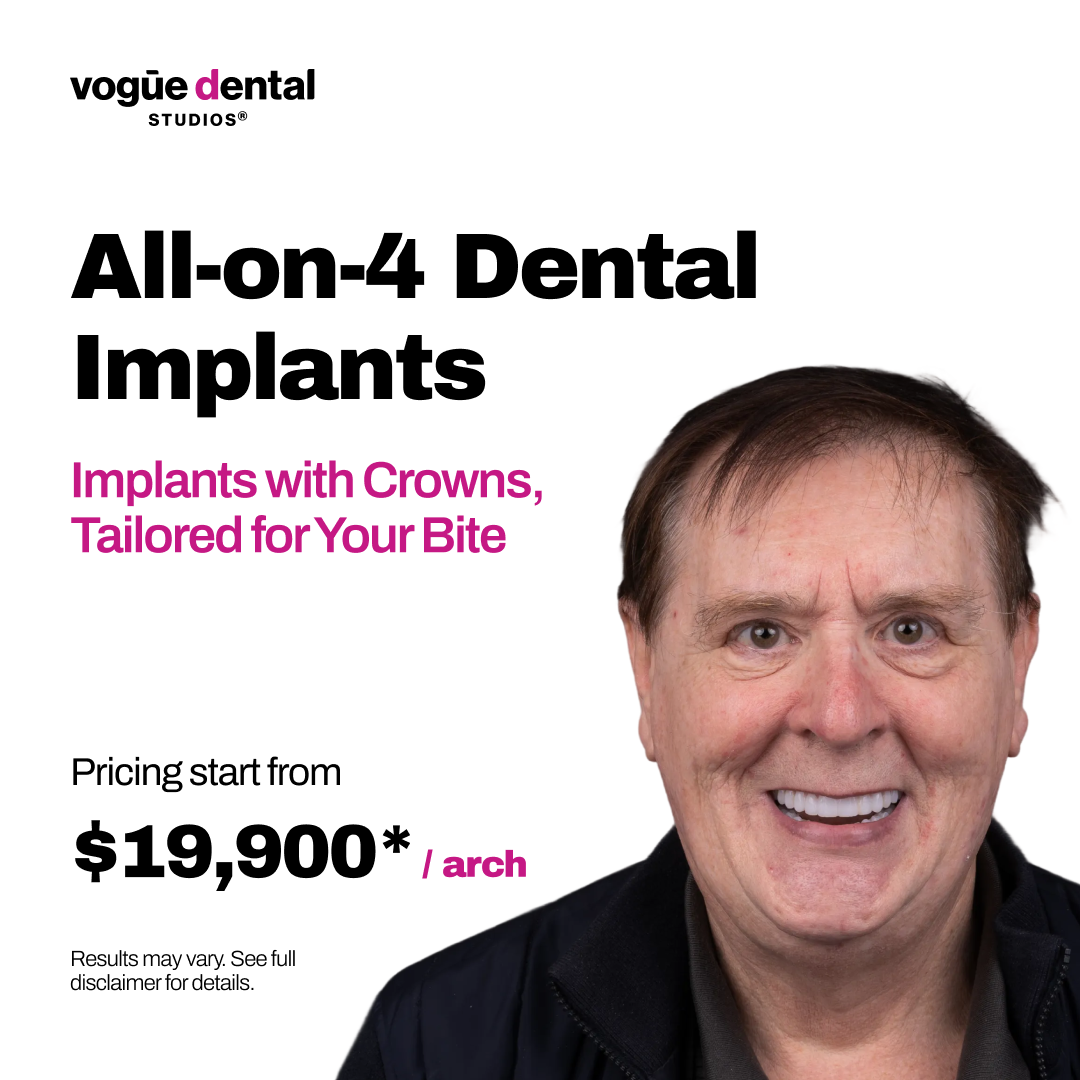 Vogue Dental Studios Facebook ad