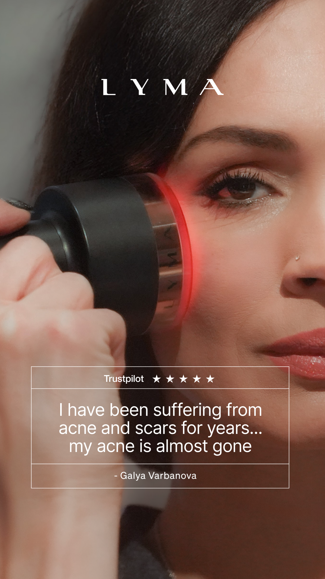 LYMA Facebook ad