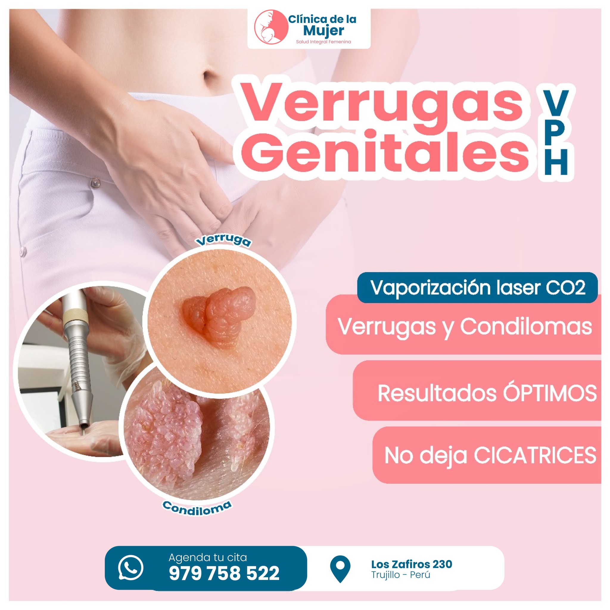 Clínica de la Mujer Salud Facebook ad: VERRUGAS GENITALES