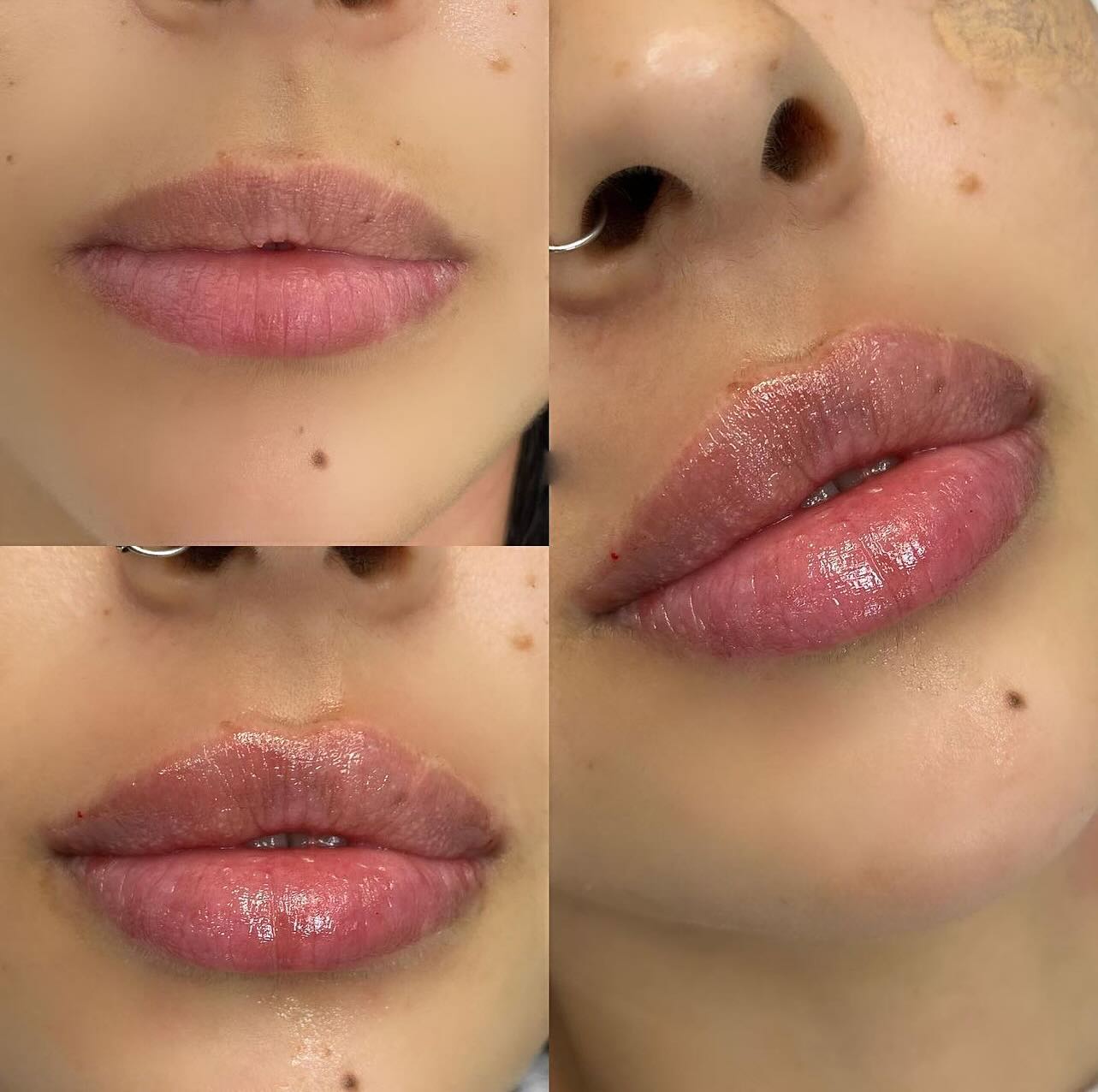 BeautyBar Facebook ad: Lip Enhancement ⁣⁣1ml