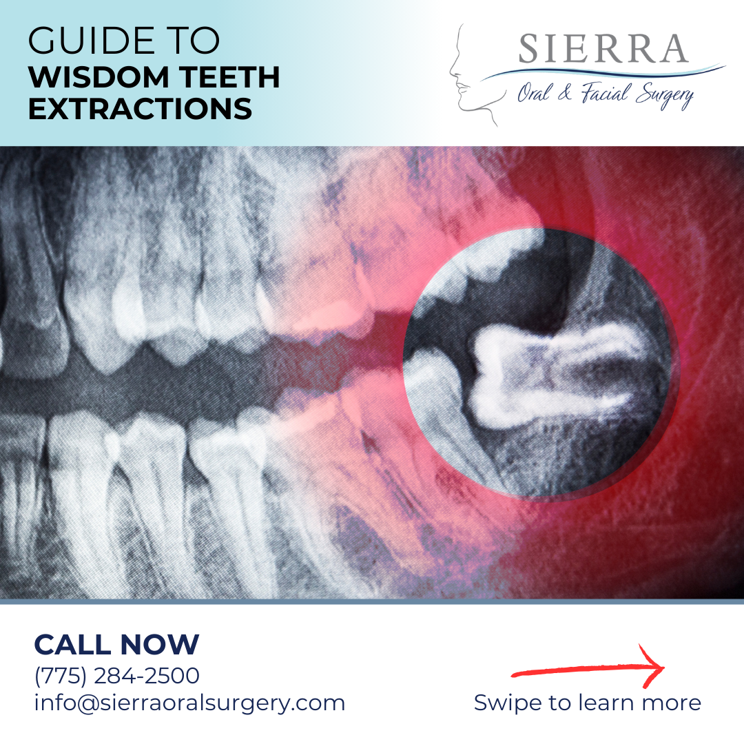 Sierra Oral & Facial Surgery Facebook ad: Our number one goal is to provide exceptional…