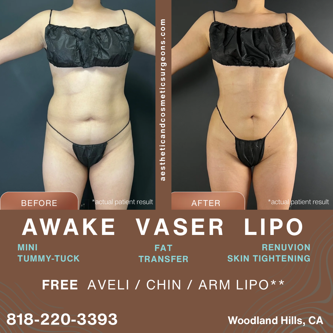 Aesthetic & Cosmetic Surgeons Facebook ad