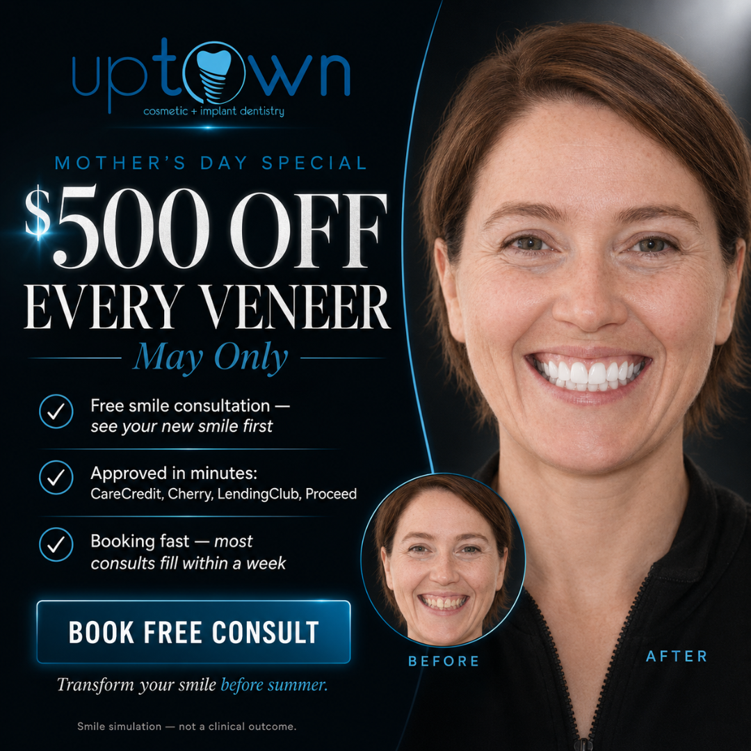 Uptown Cosmetic & Implant Dentistry Facebook ad: Dental Veneers