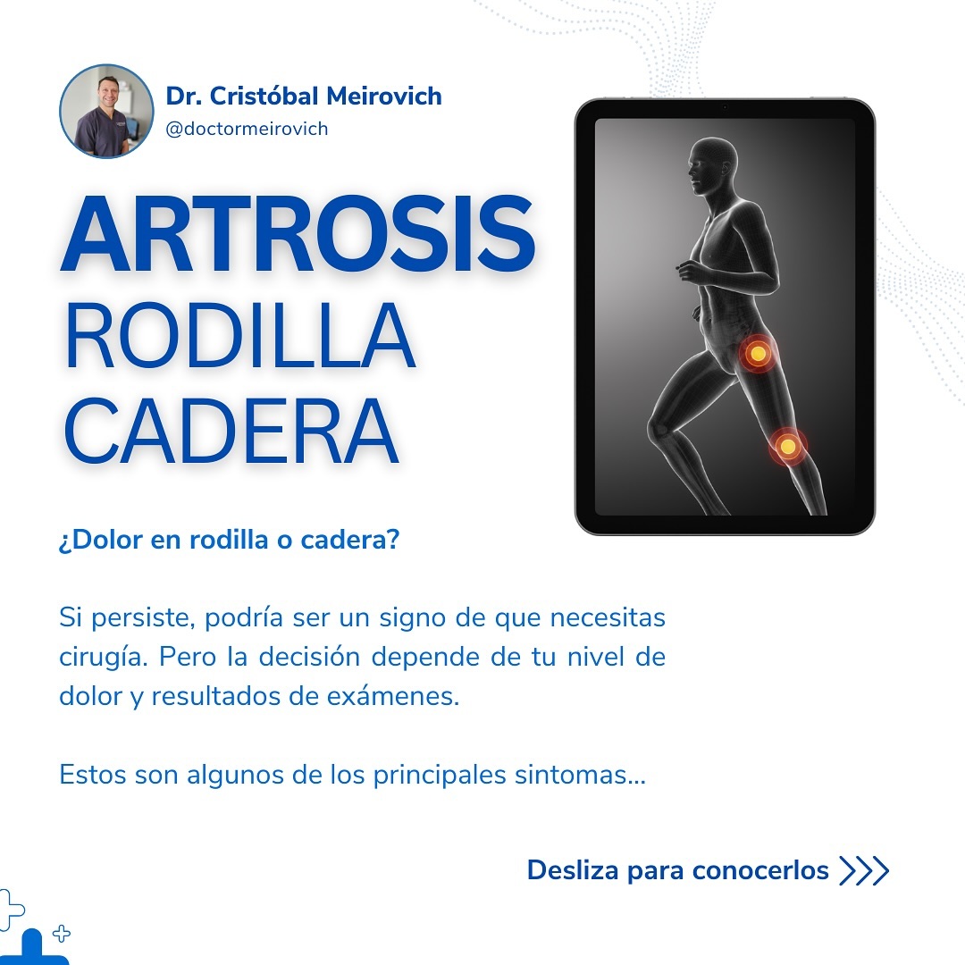Cirugía Cadera y Rodilla Facebook ad: ¿Sufres de dolor en la cadera o rodilla?
