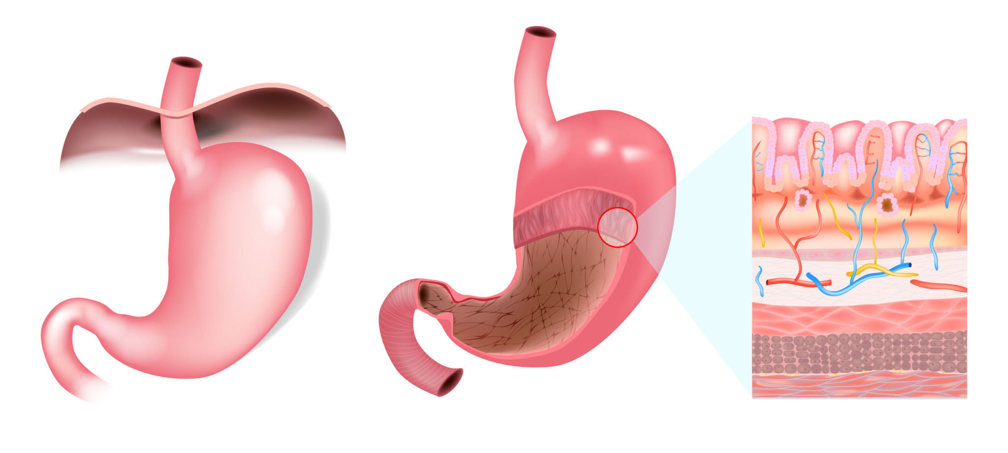 My Esophagus and Me Facebook ad