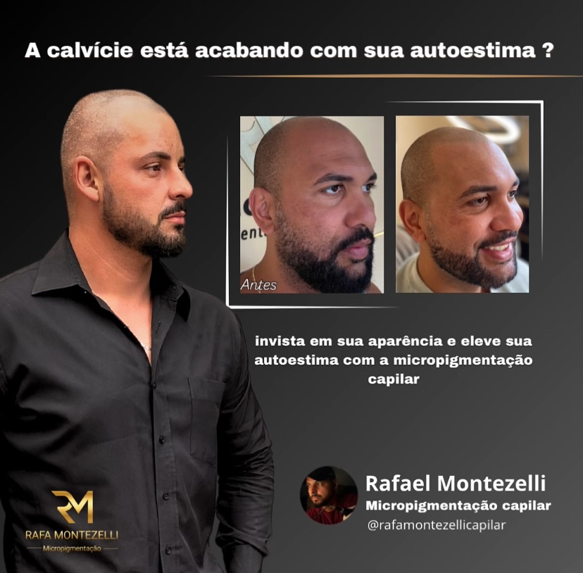 Rafa Montezelli Capilar Facebook ad: Ei você, que sofre com a calvície!