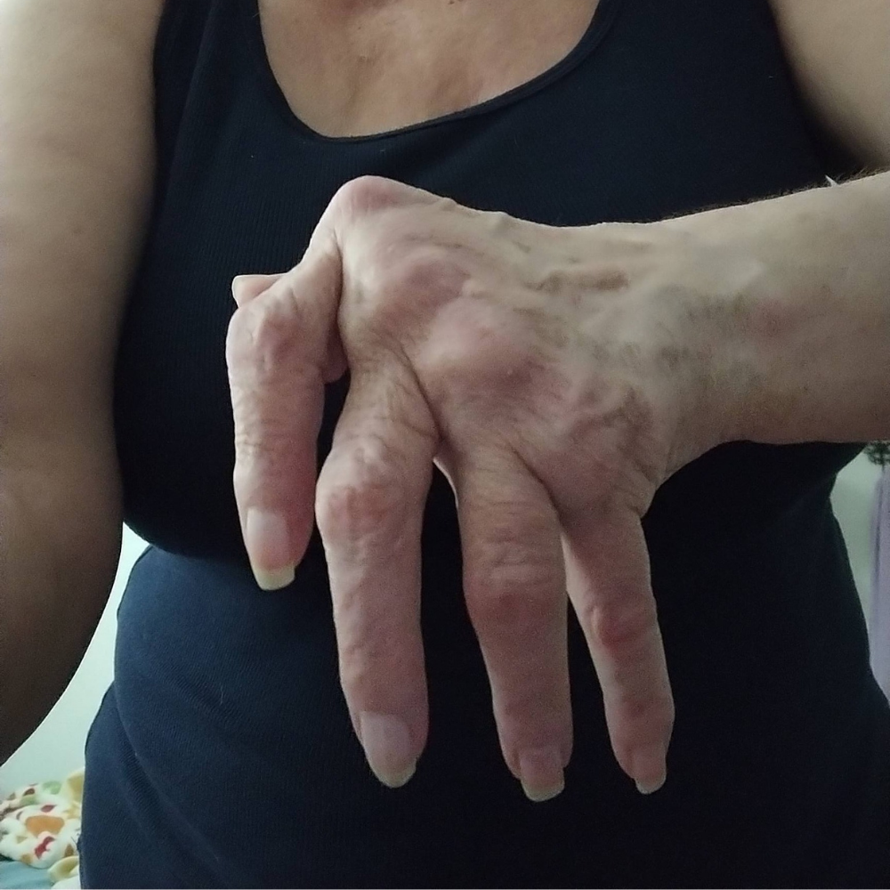 The Menopause Journal Facebook ad: Menopause did this to her hands