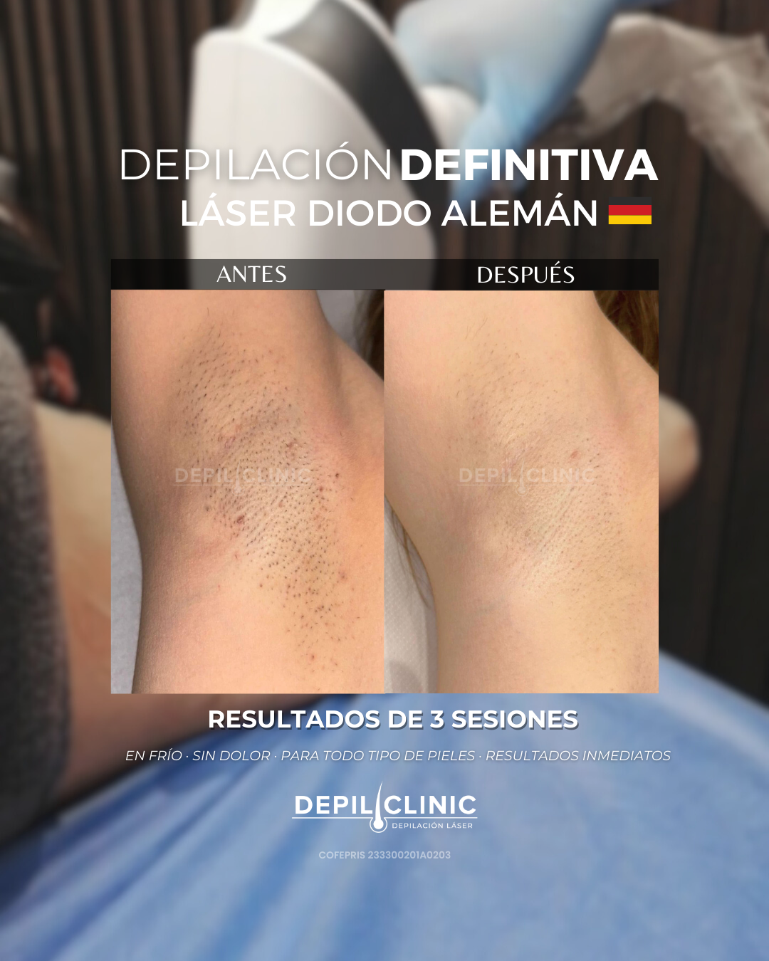 Depiliclinic Facebook ad